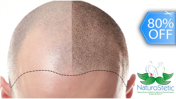[Imagen:¡Recupera tu Hermosa Cabellera! ¡Paga Q299 en lugar de Q1,500 por 2 Sesiones de Plasma Rico en Plaquetas + Terapia de Luz LED para Alopecia (Calvicie)!]