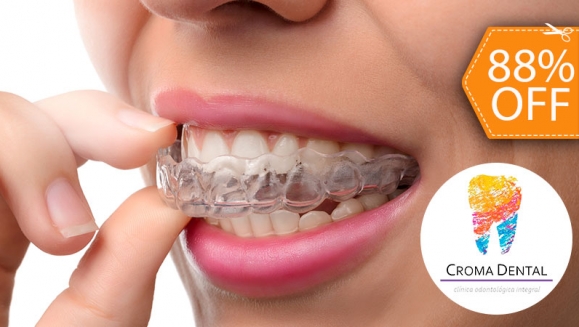 [Imagen:¡Paga $15 en Lugar de $125 por Férula Dental + Evaluación Dental!]