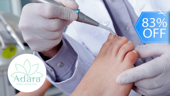 [Imagen:¡Paga Q199 en lugar de Q1,200 por 2 Sesiones para Eliminar Hongos en hasta 10 Uñas de Manos o Pies + Diagnostico Profesional!]
