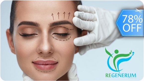 [Imagen:¡Paga Q999 en Lugar de Q4,500 por Lifting de Párpados (Superiores o Inferiores) o de Labio Superior (Código de Barras) con Plasma Láser!]