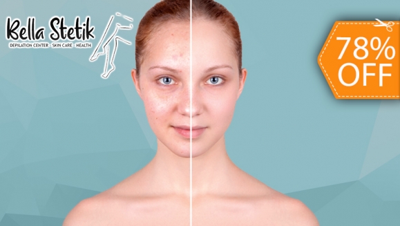 [Imagen:¡Paga $20 en Lugar de $90 por 2 Sesiones Faciales que Incluyen: 1 Microdermoabrasión + 1 Peeling Mandélico + 1 Extracción de Puntos Negros + 1 Exfoliación + 1 Mascarilla de Carbón + 2 Serum Hidratantes y Más!]