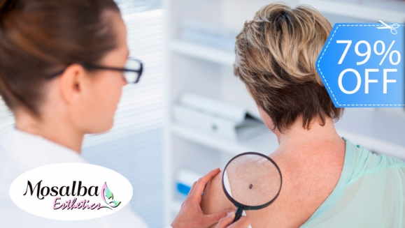 [Imagen:¡Paga Q149 en Lugar de Q700 por Cauterización Láser de hasta 15 Cabezas de Vena, 6 Lunares o 6 Verrugas de hasta 5mm + Evaluación Médica!]