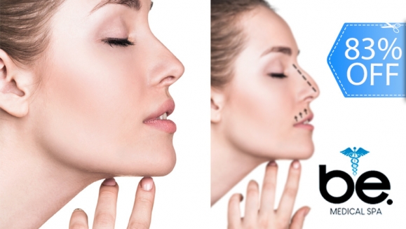 [Imagen:¡Paga Q1,899 en Lugar de Q11,000 por Rinomodelación o Rejuvenecimiento Facial con Hilos Tensores + PRP + Aplicación de Ácido Hialurónico o Plasma Gel + 1 Limpieza Facial Profunda + Microdermoabrasión + Evaluación!]