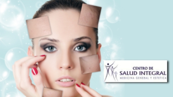 [Imagen:¡Paga $35 en lugar de $180 por 4 sesiones de peeling químico facial que incluye: 4 aplicaciones de ácido glicólico + 4 altafrecuencias + hidratación y protección solar + mascarilla anti-envejecimiento o anti-acné en El Centro de Salud Integral!]