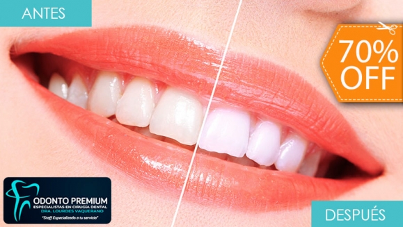 [Imagen:¡Paga $59 en Lugar de $195 por Blanqueamiento Dental Químico con Luz LED + Limpieza Manual + Profilaxis (Pulido Dental) + Consulta Odontológica!]