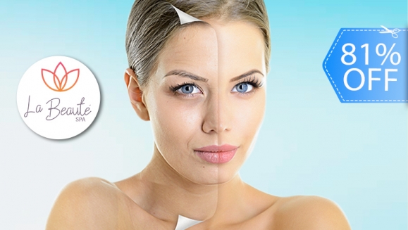 [Imagen:¡Paga Q169 en Lugar de Q867 por 2 Sesiones de Rejuvenecimiento Facial que Incluye: 2 Láser IPL + 2 Limpiezas Faciales + 2 Aplicaciones de Serum de Retinol + 2 Aplicaciones de Vitamina C + 2 Aplicaciones de Filtro Solar!]