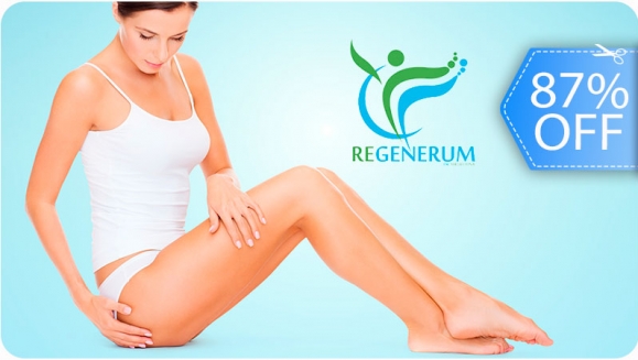 [Imagen:¡Paga Q199 en Lugar de Q1,500 por 1 Sesión de Láser o de Espuma Esclerosante para Eliminar Varices o Venas Tipo Arañitas + Evaluación Médica!]