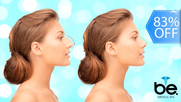 [Imagen:¡Paga Q1,899 en Lugar de Q11,000 por Rinomodelación o Rejuvenecimiento Facial con Acido Hialurónico (1 Jeringa) + PRP + Limpieza Facial Profunda + Microdermoabrasión + 1 Sesión de Lipólisis QUEMA GRASA CORPORAL!]