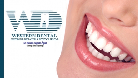 [Imagen:¡Paga $32 en lugar de $150 por Diagnóstico Buco-Dental + Limpieza con Ultrasonido + Aplicación de Flúor + 1 Radiografía + 2 Rellenos Estéticos de Resina Blanca en Western Dental! Obtén 20% de descuento en tratamientos adicionales]
