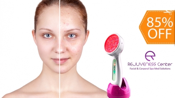 [Imagen:¡Paga $90 en Vez de $600 por 4 Sesiones Faciales con Tecnología LUZ LED para Eliminar Acné, Manchas o Arrugas + 4 Limpiezas Profundas con Extracción de Puntos + 4 Aplicaciones de Ácido Láctico!]