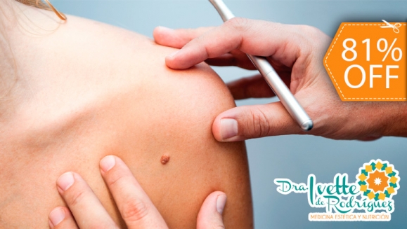 [Imagen:¡Paga $18 en lugar de $95 Electo-Cauterización de hasta 20 Verrugas!]