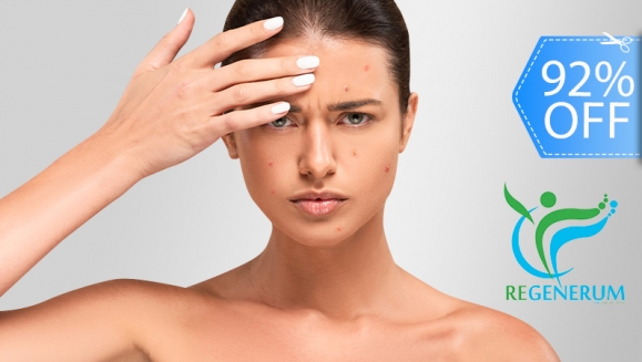 [Imagen:¡Paga Q69 en Lugar de Q850 por Facial Antiacné o Antimanchas que Incluye: Sesión Láser o Peeling + Limpieza Facial + Extracción de Puntos + Mascarilla Personalizada + Hidratación + Protección Solar!]