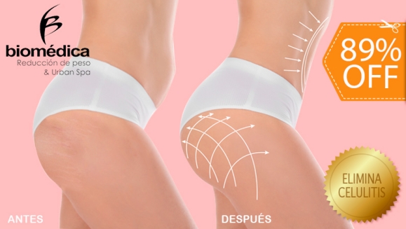 [Imagen:¡Paga $22 en vez de $200 por Tratamiento "GLUPACK 4 en 1": Levanta los Glúteos, Reduce Las Piernas, Moldea Las Caderas y Elimina La Celulitis con: 5 Nanofrecuencias Brasileñas + 3 Maderoterapias + 3 Lumicell y Más + 2 Limpiezas Faciales con THE CLAY!]