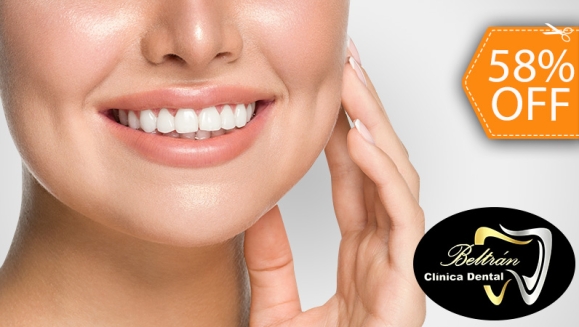 [Imagen:¡Paga $50 en Lugar de $120 por Blanqueamiento Dental Químico con Luz LED + Limpieza Profunda con Ultrasonido (Detartraje) + Consulta Odontológica!]