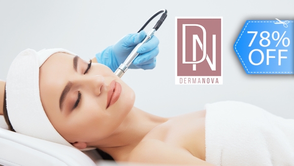[Imagen:¡Paga Q99 en Lugar de Q450 por Facial de Limpieza Profunda que Incluye: Peeling Ultrasónico + Microdermoabrasión + Altafrecuencia + Extracción de Puntos Negros + Exfoliación + Mascarilla Revitalizante!]