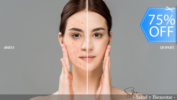 [Imagen:¡Paga Q99 en Lugar de Q400 por Facial Antiacné que Incluye: Peeling + Mascara LED + Altafrecuencia + Ultrasonido + Vapor y Ozono para Manchas + Mascarilla Especializada + Exfoliación + Vitamina C! Dejando a la vista la piel renovada que deseas!]