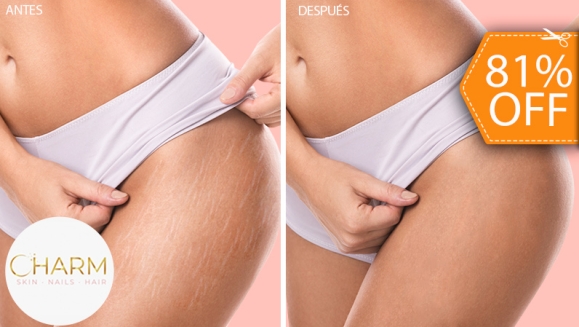 [Imagen:¡Paga $28 en Lugar de $150 por 1 Sesión para Reducción de Estrías con 1 Plasma Rico en Plaquetas o Extracto de Colágeno con Dermógrafo + 1 Microdermoabrasión + 1 Altafrecuencia + 1 Mascarilla de Colágeno + 1 Mascarilla Hidratante y Más!]