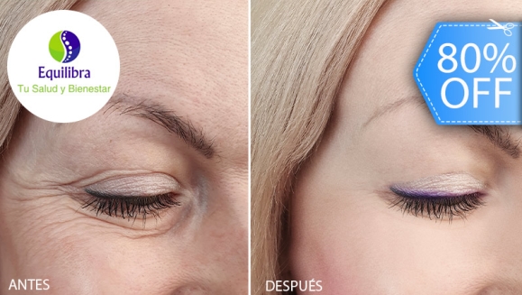 [Imagen:¡Paga Q499 en Vez de Q2,500 Blefaroplastia Sin Cirugía con Tecnología Plasma PlexR para Eliminar Párpados Caídos, Arrugas, Manchas, Lunares y Marcas de Acné + Rejuvenecimiento con Relleno Plasma Gel en Entrecejo, Patas de Gallo o Surco Nasogeniano!]