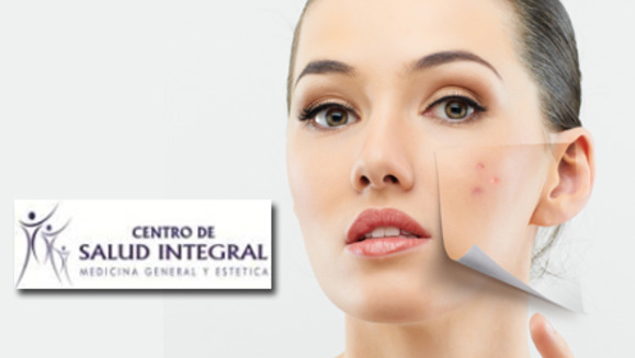 [Imagen:¡Paga $30 en lugar de $140 por una Sesión de Microdermoabrasión más limpieza profunda + 2 Sesiones de Peeling +   3 Mascarillas Anti-envejecimiento o Anti-inflamatoria + 3 Altafrecuencias  + Evaluación con Lámpara Wood en Centro de Salud Integral!]