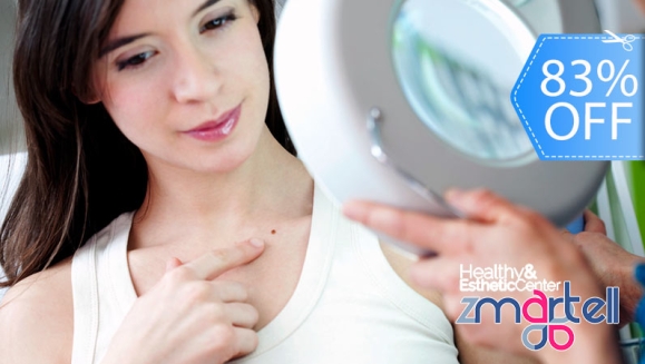 [Imagen:¡Paga Q149 en Lugar de Q900 por Cauterización Láser de hasta 20 Cabezas de Vena o 4 Lunares o 4 Verrugas (de hasta 5 mm) + Evaluación Médica!]