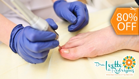 [Imagen:¡Paga $18 en Lugar de $90 por 2 Sesiones de Láser para 3 Uñas con Hongos + Evaluación Médica!]