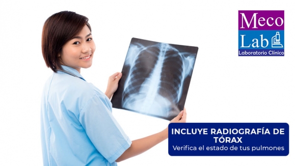 [Imagen:¡Paga $18 en Lugar de $150 por Opción A: Prueba PCR (Proteína C Reactiva) + 19 Exámenes de Laboratorio u Opción B: Prueba PCR (Proteína C Reactiva) + Radiografía de Tórax!]