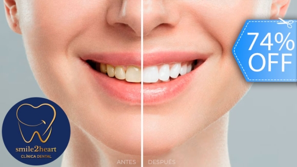 [Imagen:¡Paga Q395 en Lugar de Q1,500 por Blanqueamiento con Luz LED + Pulido Dental + Plan de Tratamiento + Evaluación con Cámara Intraoral!]