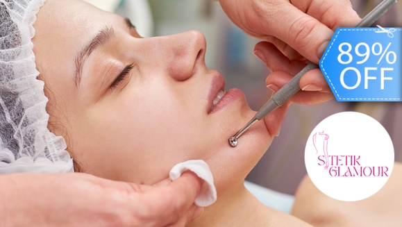 [Imagen:¡Paga Q89 en vez de Q800 por 2 Sesiones de Limpieza Facial Profunda con Microderm Vacum + Radiofrecuencia + Extracción de Puntos Negros + Exfoliación + Mascarilla de Arcilla o Carbón Activado + Aplicación de Vitamina E y Bloqueador Solar!]