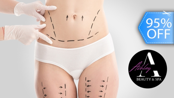 [Imagen:¡Paga Q299 en Vez de Q5,700 por 150 Tratamientos de Liporeducción y Lipoescultura con 30 Mesoterapia + 20 Electroreafirmantes + 20 Lipoláser + 10 Ultracavitaciones + 10 Maderoterapias + 20 Geles Termo-activos + 2 Desintoxicaciones Iónicas y Más!]