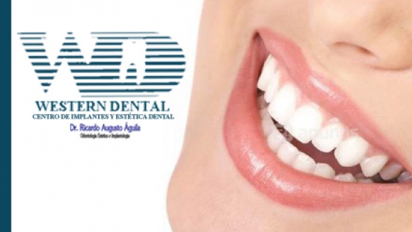 [Imagen:¡Paga $30 en lugar de $150 por Consulta Odontológica + Diagnóstico Buco-Dental con cámara intraoral + Limpieza con Ultrasonido + 1 radiografía + 2 rellenos estéticos o 4 sellantes en Western Dental! Recibe 20% de descuento en servicios adicionales.]