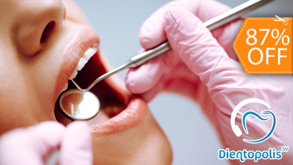 [Imagen:¡Paga $25 en Lugar de $188 por 3 Rellenos o 4 Sellantes + Limpieza Dental con Ultrasonido + Aplicación de Flúor + Consulta y Diagnostico Bucodental + Evaluación de Cordales!]