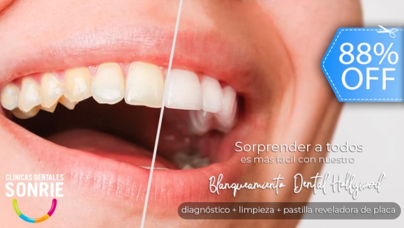 [Imagen:¡Paga Q449 en Lugar de Q3,598 por Blanqueamiento Dental con Luz LED + Limpieza Ultrasónica Profunda con Eliminación de Sarro y de Manchas de Colorantes con Pulido Profiject + Pastilla Reveladora de Placa + Diagnóstico Integral Completo!]