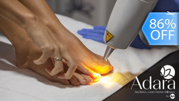 [Imagen:¡Paga Q275 en Lugar de Q1,900 por 3 Sesiones Láser en 10 Uñas para Eliminar Hongos + Aplicación de Medicamento Antimicótico!]