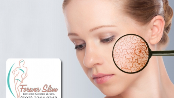 [Imagen:¡Paga $45 en lugar de $315 por Paquete Facial de 14 tratamientos: 1 Microdermoabrasión + 3 Limpiezas + 2 Lifting + 2 Exfoliaciones enzimáticas + 2 Mascarillas de Colágeno + 2 Crioterapias + 1 Altafrecuencia + 1 Mascarilla Hidratante en Forever Slim!]
