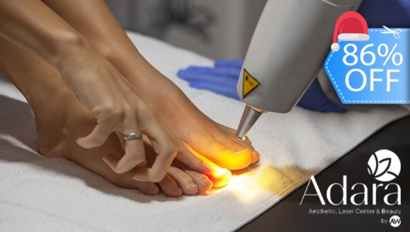 [Imagen:¡Paga Q275 en Lugar de Q1,900 por 3 Sesiones Láser en 10 Uñas para Eliminar Hongos + Aplicación de Medicamento Antimicótico!]