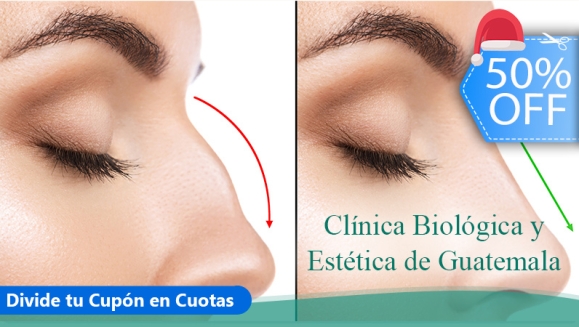 [Imagen:¡Paga Q999 en Lugar de Q2,000 por Rinomodelación con Ácido Hialurónico: Perfila, Modela y Respinga la Punta de La Nariz Sin Cirugía!]