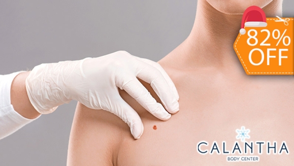 [Imagen:¡Paga $18 en Lugar de $100 por Electrocauterización de hasta 20 Verrugas!]