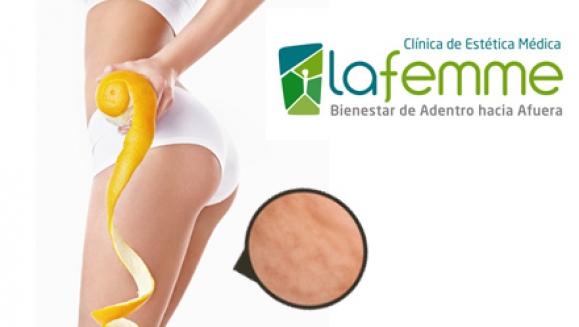 [Imagen:¡Paga Q150 en lugar de Q1150 por Paquete Anticelulítico de 10 tratamientos que incluye: 3 Masajes Anticelulíticos + 3 Lipocavitaciones + 3 Endermologies + 1 Gel de Algas Reafirmante en La Femme! Recibe adicional 1 Sesión Nutricional]