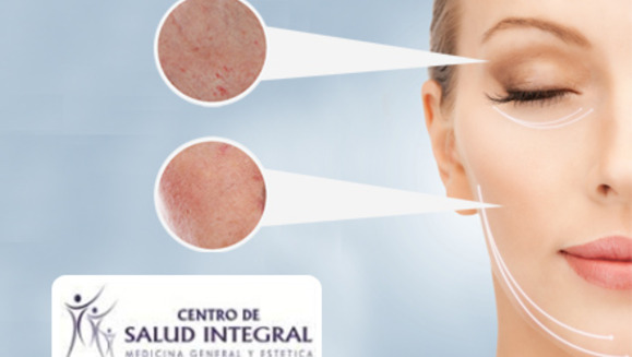 [Imagen:¡Paga $40 en lugar de $180 por una sesión de Microdermoabrasión con Limpieza Profunda + 2 sesiones de Miami Peeling + 3 Mascarillas + 3 Altafrecuencias + Evaluación Médica en el Centro de Salud Integral!]