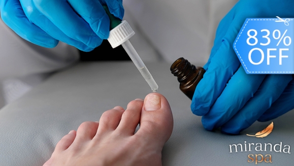 [Imagen:¡Paga Q250 en Lugar de Q1,500 por 1 Sesión para Eliminar Hongos Hasta en 10 Uñas con Ácidos + Diagnóstico Profesional + Aplicación de Crema Antimicótica + Pedicure Clínico!]