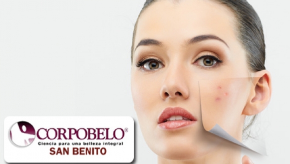[Imagen:¡Paga $35 en lugar de $222 por 3 Microdermoabrasiones con Punta de Diamante + 3 sesiones de Colágeno en Corpobelo San Benito!]