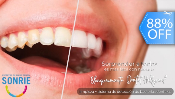 [Imagen:¡Paga Q449 en Lugar de Q3,598 por Blanqueamiento Dental Ultra White + Limpieza Ultrasónica Profunda con Eliminación de Sarro y de Manchas de Colorantes con Pulido Profiject + Sistema de Detección de Bacterias Dentales!]