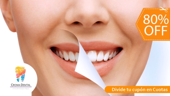 [Imagen:¡Paga $50 en Lugar de $255 por Blanqueamiento Dental Químico con Luz LED + Limpieza Profunda con Ultrasonido (Destartraje) + Consulta Odontológica!]