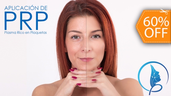 [Imagen:¡Paga $180 en Lugar de $450 por 3 Sesiones de Plasma Rico en Plaquetas para Rejuvenecimiento Facial o Calvicie + 3 Limpiezas Faciales con 3 Microdermoabrasiones + 3 Extracciones de Puntos Negros + Consulta Médica!]