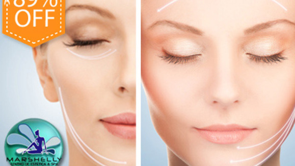[Imagen:¡Paga $49 en lugar de $450 por paquete facial Anti Edad que incluye: 1 Microdermoabrasión con Microcristales + Inyectaje de Ácido Hialurónico y Colágeno + Exfoliante + Luz Galvánica + Radiofrecuencia + 2 limpiezas profundas en Marshelly!]