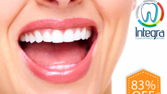 [Imagen:¡Paga Q199 en lugar de Q1200 por Blanqueamiento Ambulatorio + Pulido y Desmanchado Dental + Eliminación de Sarro + Set de Fotografías Intraorales + Remineralización + Aplicación de Flúor + Evaluación Clínica en Integra Especialidades Dentales!]