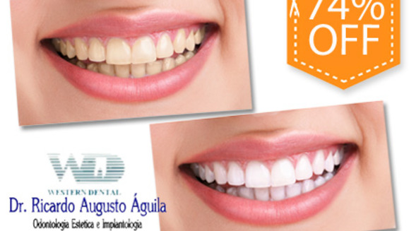 [Imagen:¡Paga $85 en vez de $325 por 1 Sesión de Blanqueamiento Dental con Sistema Zoom + Consulta Odontológica + Diagnóstico con Cámara Intraoral + Limpieza con Ultrasonido en la lujosa sala VIP de Western Dental San Benito!]