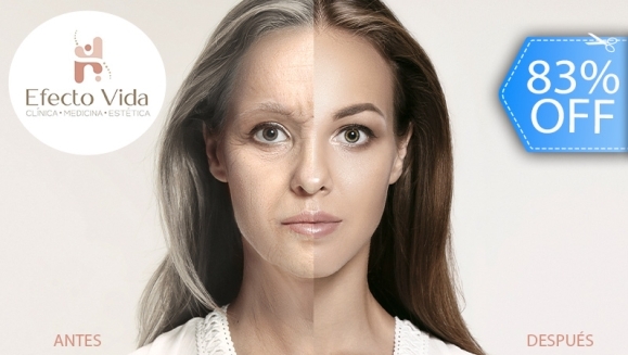 [Imagen:¡Paga Q75 en Lugar de Q450 por Rejuvenecimiento Facial que Incluye: 1 Láser IPL + 1 Limpieza Facial + 1 Aplicación de Serum de Retinol + 1 Aplicación de Vitamina C + 1 Aplicación de Filtro Solar!]