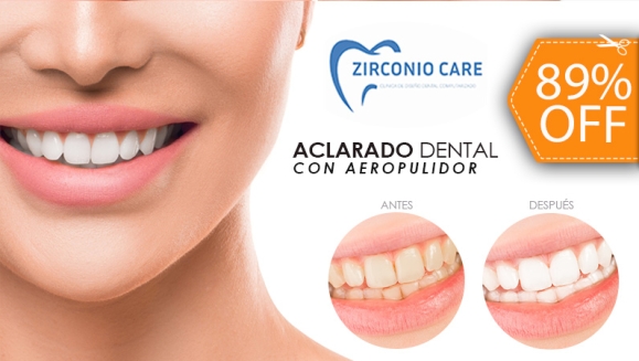 [Imagen:¡Paga $20 en Lugar de $190 por Aclarado Dental con Aeropulidor + Limpieza Dental con Ultrasonido + 2 Rellenos Estéticos de Resina + Aplicación de Flúor!]