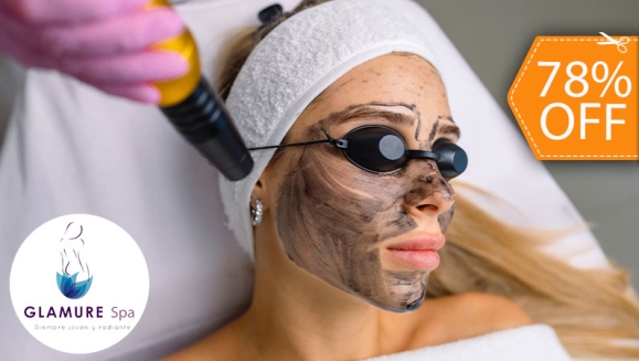 [Imagen:¡Paga $19 en Vez de $85 por Novedoso Facial de Rejuvenecimiento “Hollywood Peel” con Microdermoabrasión con Punta de Diamante + Aplicación de Láser + Mascarilla de Carbón Activado + Extracción de Puntos Negros + Exfoliación + Hidratación y Más!]